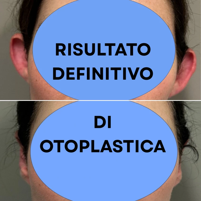  Otoplastica Dott. Mario Prandi 